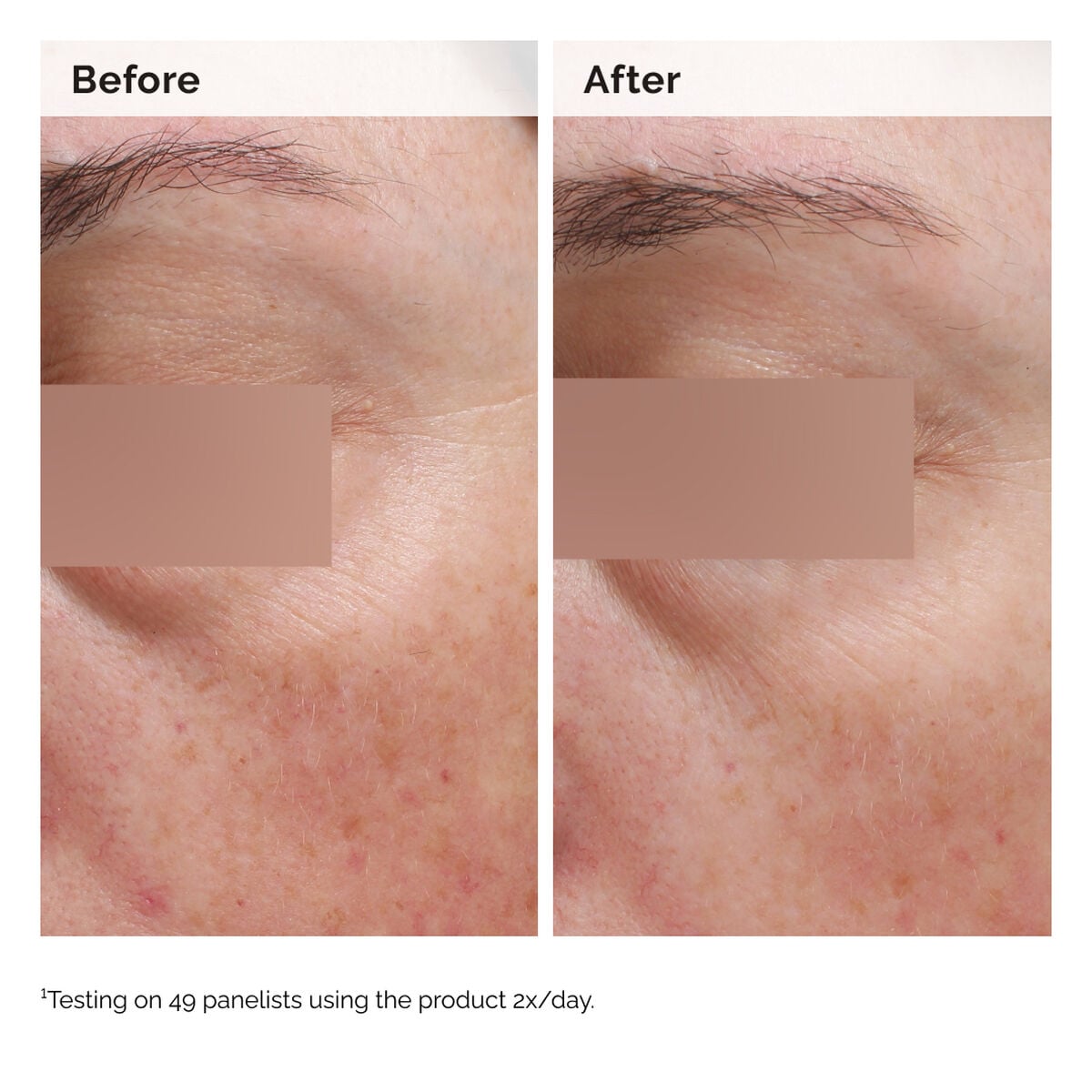 niacinamide-5-face-and-body-emulsion-r4 2024-08-23-ORD-Nia-5pct-Face-Body-B-A-Elasticity-Global-02-1x1.jpg