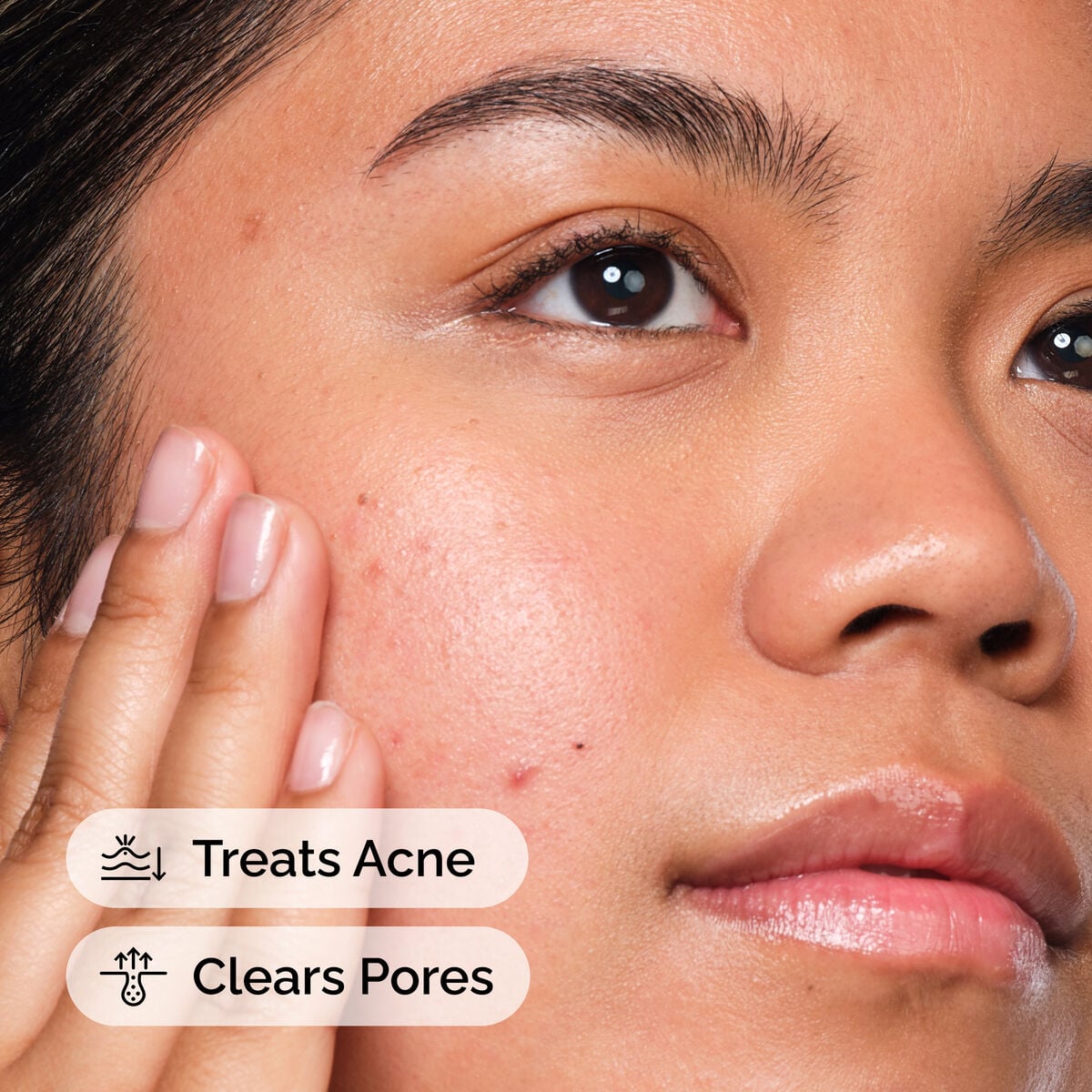 salicylic-acid-2-solution-v9 FY25-D41247-ORD-Web-SA-Sltn-1x1-CA-US-EN-4d.jpg