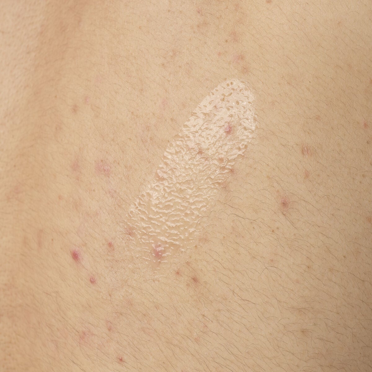 salicylic-acid-0-5-body-serum-k3 ORD-salicylic-acid-05-body-240ml-application.jpg