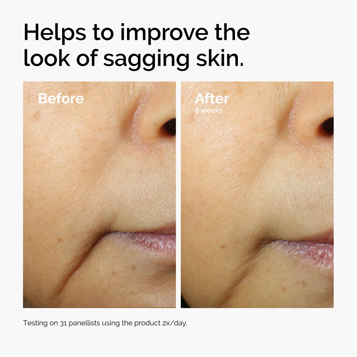 caffeine-3-escin-1-face-serum-l6 ord-caffeine-3pct-escin-1pct-face-serum-before-after-sagging.jpg