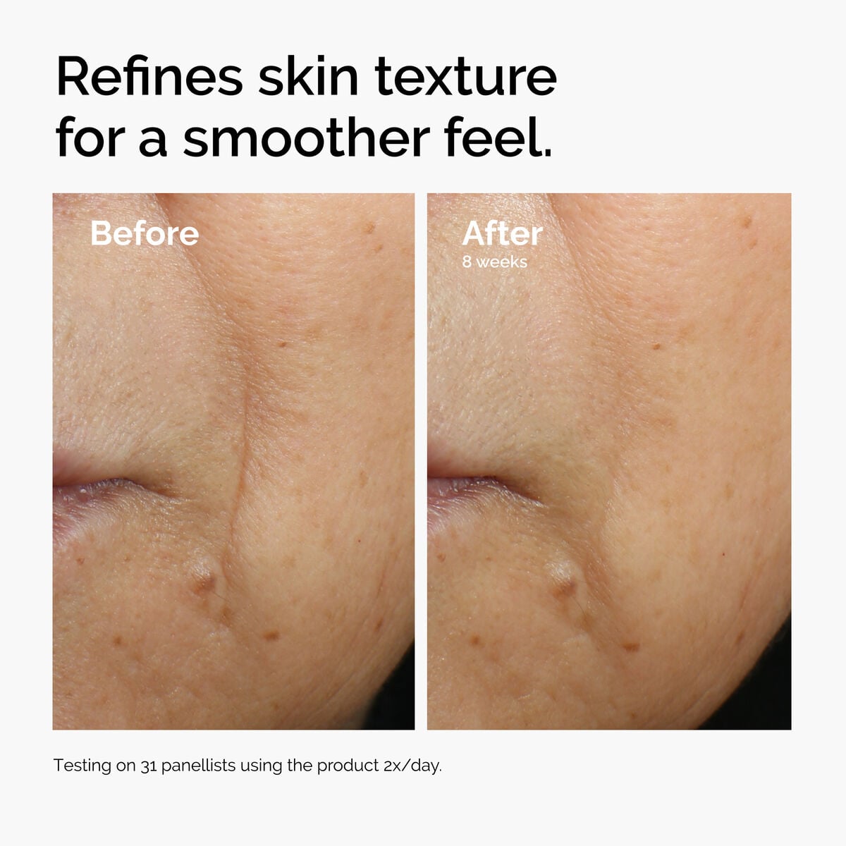 caffeine-3-escin-1-face-serum-l6 ord-caffeine-3pct-escin-1pct-face-serum-before-after-texture.jpg