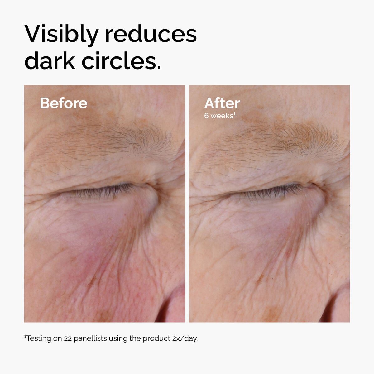 caffeine-solution-5-egcg-eye-serum-y1 ord-caffeine-solution-egcg-dark-circles-before-after.jpg