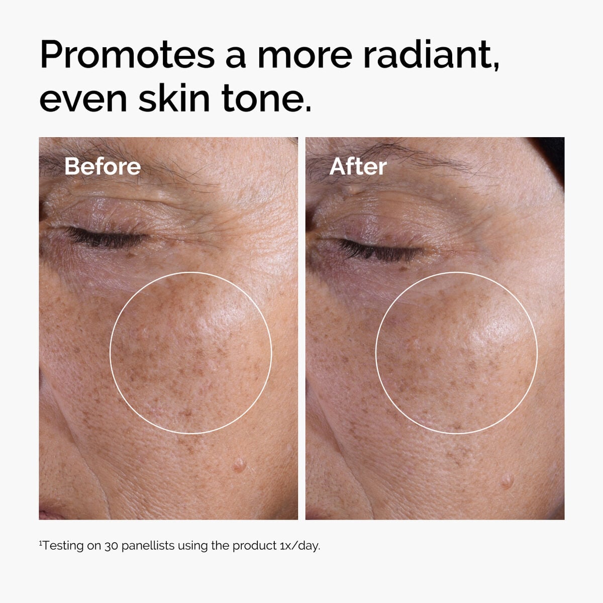 glycolic-acid-7-exfoliating-toner-o1 ord-glycolic-before-after-radiance.jpg