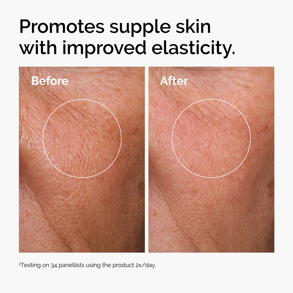 hyaluronic-acid-2-b5-with-ceramides-y9 ord-hyaluronic-acid-2pct-b5-hydrating-serum-before-after-elasticity.jpg