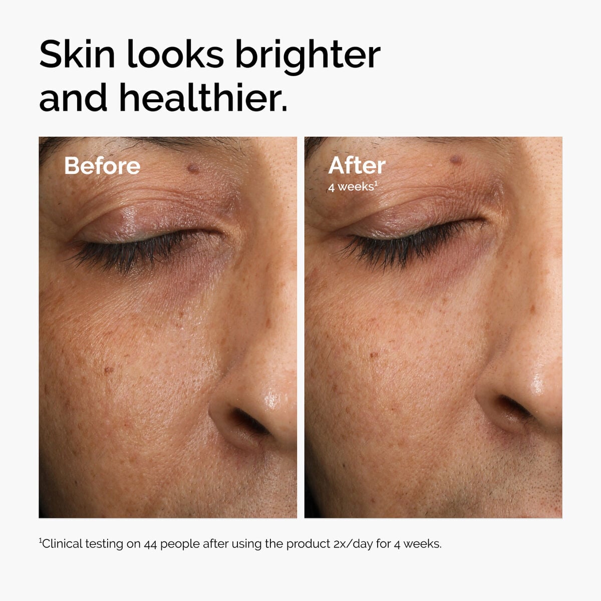 multi-antioxidant-radiance-serum-k3 ord-mars-before-after-healthy.jpg