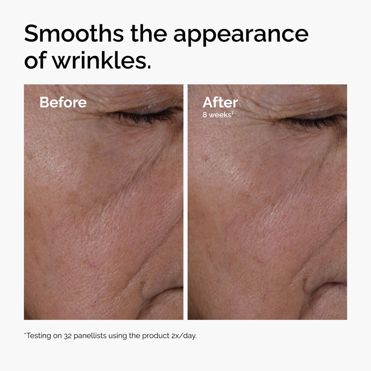 multi-peptide-ha-serum-k5 ord-multi-peptide-ha-serum-wrinkles-before-after.jpg
