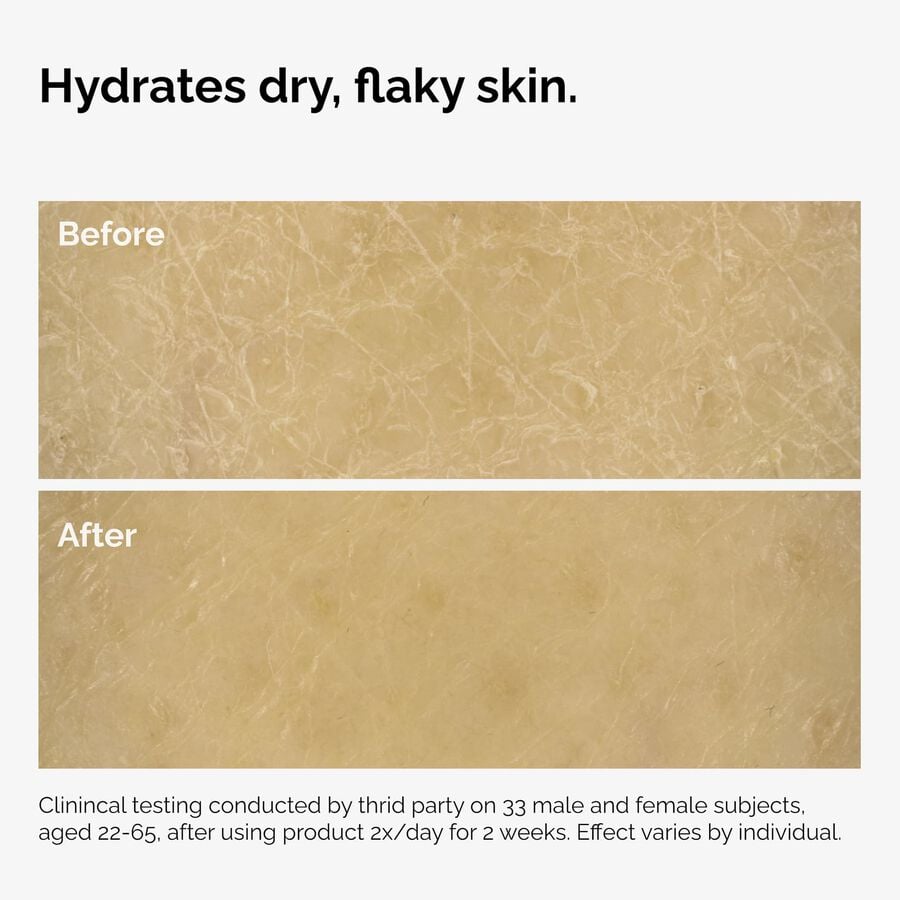 the-body-care-collection-k9 ord-natural-moisturizing-factors-inulin-body-before-after-graphic-02.jpg