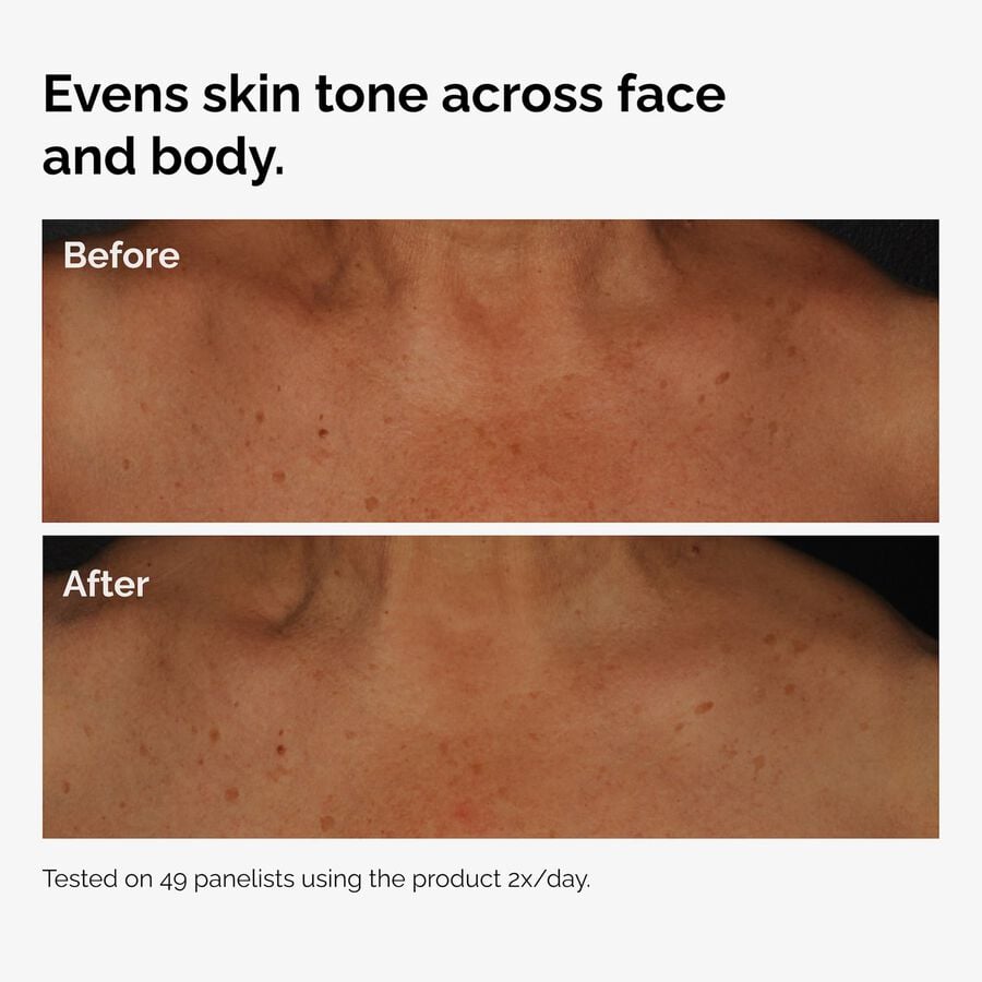 the-body-care-collection-k9 ord-niacinamide-face-body-serum-before-after-even-tone-graphic.jpg