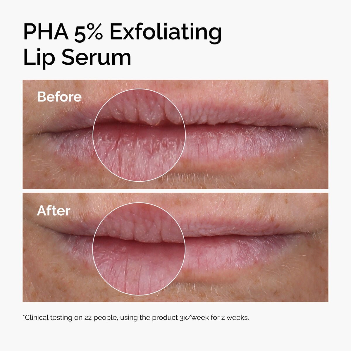 pha-5-exfoliating-lip-serum-f6 ord-pha-5pct-lip-exfoliating-serum-before-after.jpg
