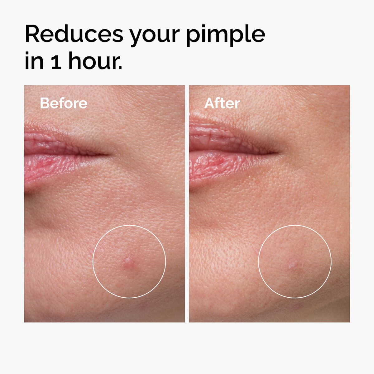 sulfur-10-powder-to-cream-concentrate-k5 ord-sulfur-10pct-powder-to-cream-concentrate-before-after-NA.jpg