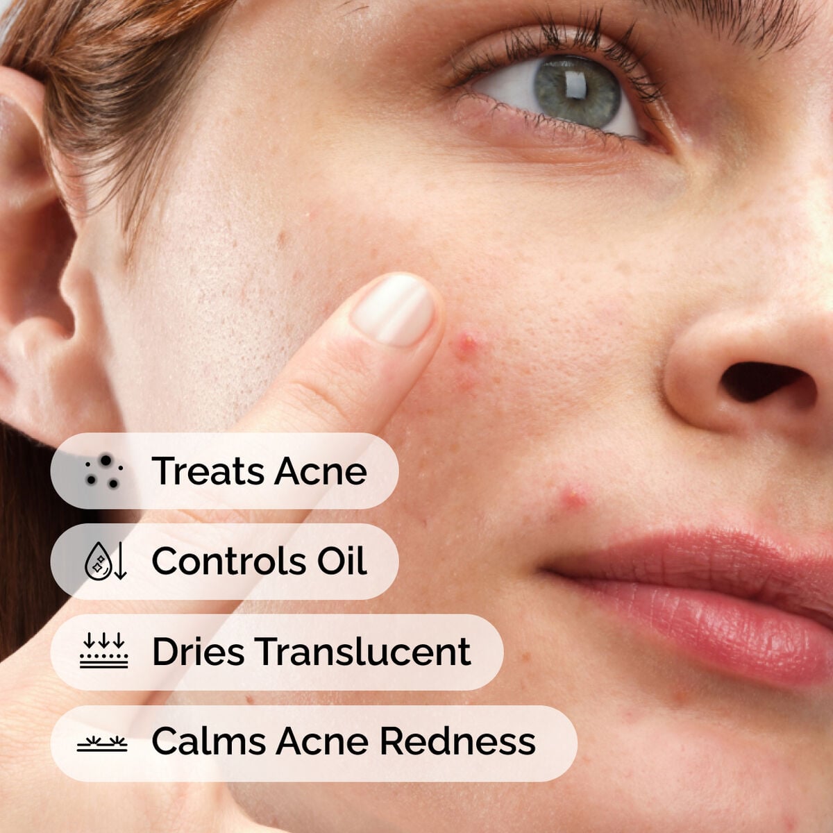 sulfur-10-powder-to-cream-concentrate-k5 ord-sulfur-10pct-powder-to-cream-concentrate-model-application-with-benefits-acne.jpg